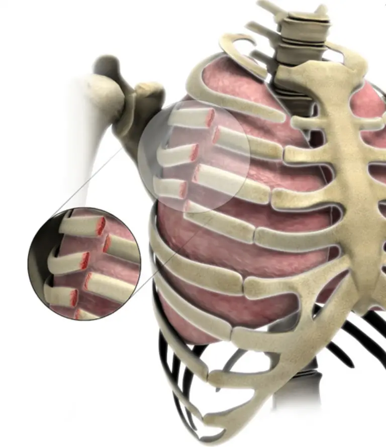 Does CPR cause Broken Ribs? Free CPR Training